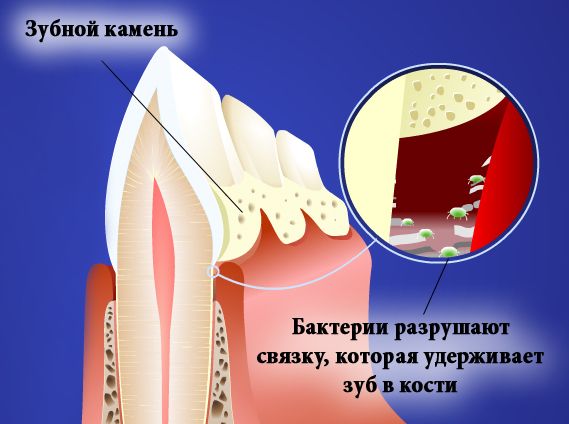 Зубной образование